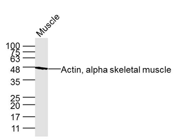 Actin, alpha skeletal muscle Mouse Monoclonal Antibody
