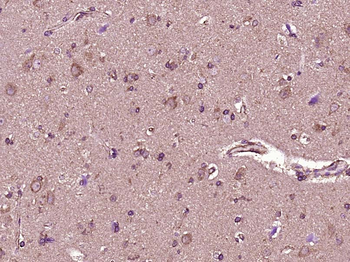 PEDF Rabbit Polyclonal Antibody