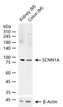 SCNN1A Rabbit Polyclonal Antibody