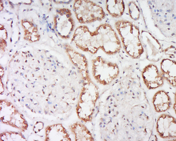 SCNN1A Rabbit Polyclonal Antibody