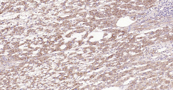CYP7A1 Rabbit Polyclonal Antibody