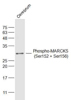 Phospho-MARCKS (Ser152 + Ser156) Rabbit Polyclonal Antibody (HRP)