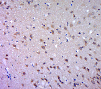 DGAT1 Rabbit Polyclonal Antibody