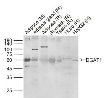 DGAT1 Rabbit Polyclonal Antibody