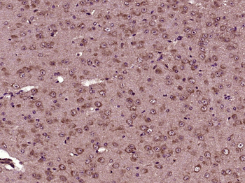 Phospho-AKT (Ser473) Mouse Monoclonal Antibody