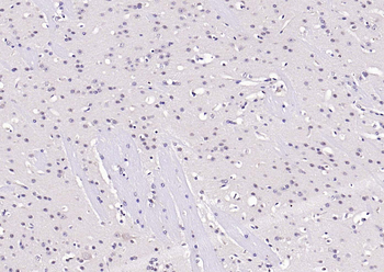Phospho-AKT (Ser473) Mouse Monoclonal Antibody