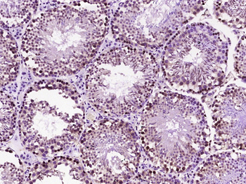 Phospho-Gli1 (T101/ S102/S104) Rabbit Polyclonal Antibody