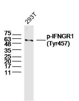 Phospho-IFNGR1 (Tyr457) Rabbit Polyclonal Antibody