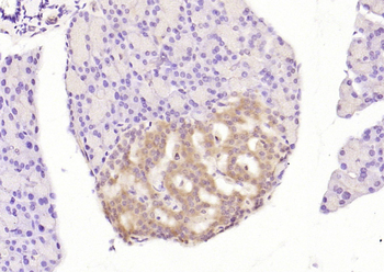 Phospho-PERK (Thr980) Rabbit Polyclonal Antibody
