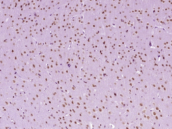 Phospho-ATF2 (Ser94) Rabbit Polyclonal Antibody