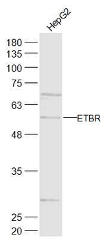 ETBR Rabbit Polyclonal Antibody