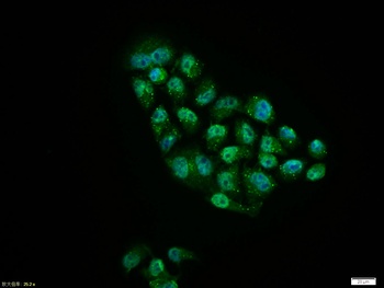 Phospho-EGFR (Ser1142) Rabbit Polyclonal Antibody