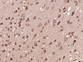 Phospho-MEK1 (Thr286) Rabbit Polyclonal Antibody