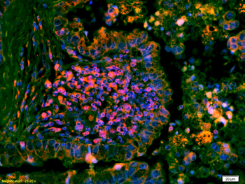 Phospho-ERK1/2 (Thr202 + Tyr204) Rabbit Polyclonal Antibody