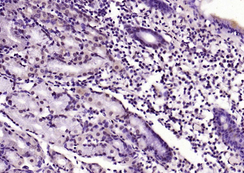 Phospho-FADD (Ser194) Rabbit Polyclonal Antibody