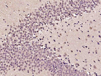 Phospho-PTK2 (Tyr576+Tyr577) Rabbit Polyclonal Antibody