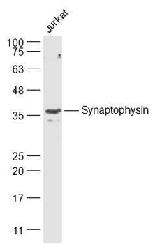 Synaptophysin Rabbit Polyclonal Antibody