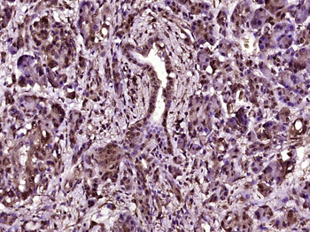 Galectin 3 Mouse Monoclonal Antibody