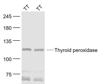 Thyroid peroxidase Rabbit Polyclonal Antibody