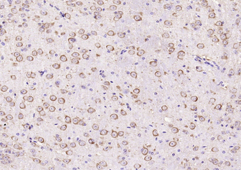 PKC delta Rabbit Polyclonal Antibody