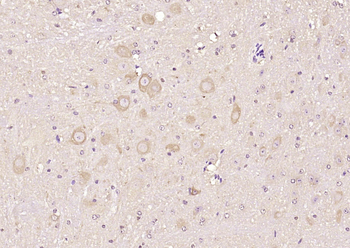 PKC delta Rabbit Polyclonal Antibody