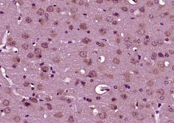 Phospho-CTNNA1 (Ser641) Rabbit Polyclonal Antibody