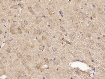 Phospho-MAP3K7IP1 (Ser423) Rabbit Polyclonal Antibody