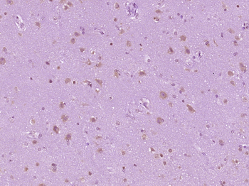 ZMYND17 Rabbit Polyclonal Antibody