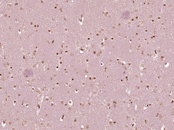 Caspase-10 Rabbit Polyclonal Antibody