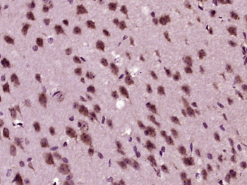 PKC delta Rabbit Polyclonal Antibody