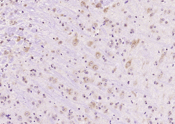 PKC delta Rabbit Polyclonal Antibody