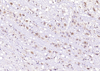 PKC delta Rabbit Polyclonal Antibody