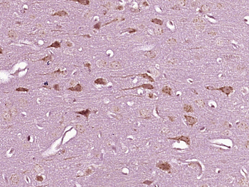 NUDT8 Rabbit Polyclonal Antibody