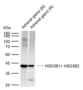 HSD3B1+ HSD3B2 Rabbit Polyclonal Antibody