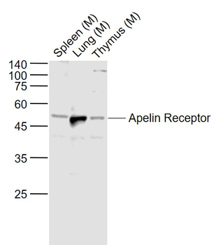 Apelin Receptor Rabbit Polyclonal Antibody