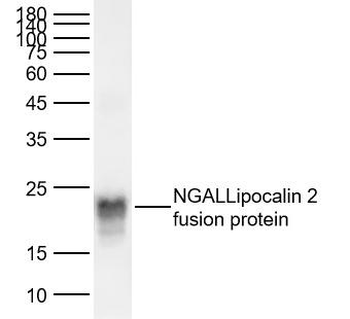 NGAL/Lipocalin 2 Rabbit Polyclonal Antibody