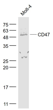 CD47 Rabbit Polyclonal Antibody