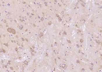 GSK-3 Beta Mouse Monoclonal Antibody