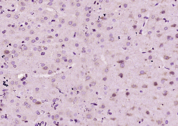 Neurotrophin 3 Rabbit Polyclonal Antibody