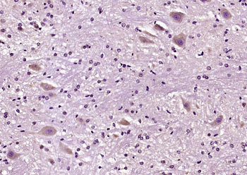 BRSK2 Rabbit Polyclonal Antibody