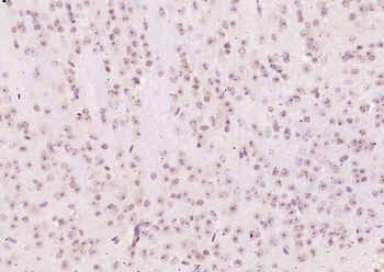 Brachyury Rabbit Polyclonal Antibody
