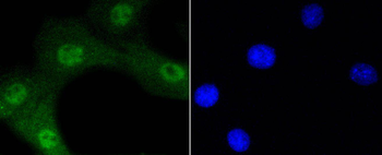 Phospho-Akt1 (Ser473) Recombinant Rabbit Monoclonal Antibody
