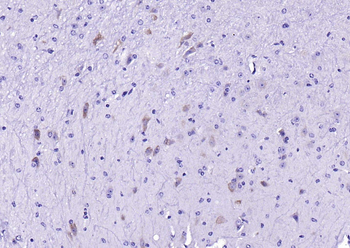 Phospho-Akt1 (Ser473) Recombinant Rabbit Monoclonal Antibody