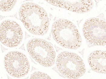Phospho-Akt1 (Ser473) Recombinant Rabbit Monoclonal Antibody