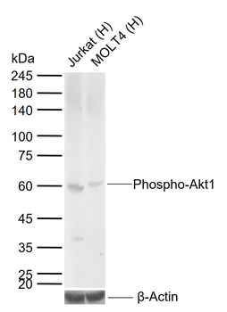 Phospho-Akt1 (Ser473) Recombinant Rabbit Monoclonal Antibody