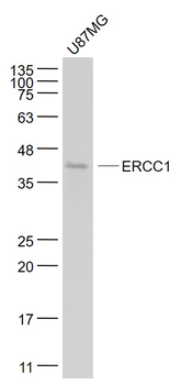 ERCC1 Mouse Monoclonal Antibody