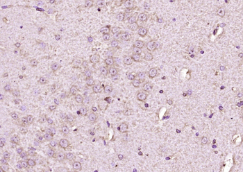 NAV1.7 Rabbit Polyclonal Antibody