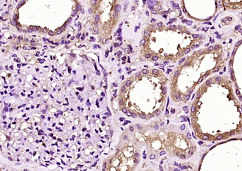 FXR1 Rabbit Polyclonal Antibody