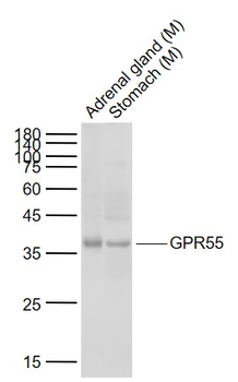GPR55 Rabbit Polyclonal Antibody