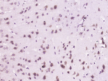 LTA4H Rabbit Polyclonal Antibody